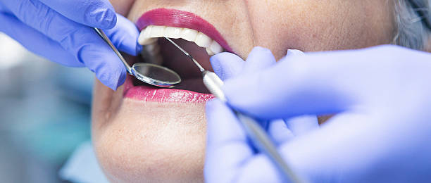 Best Dental Abscess Treatment in St Peters, MO